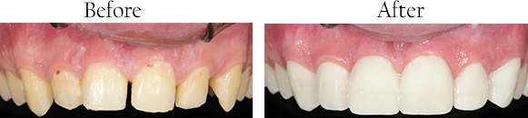 dental images 10573