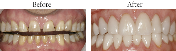Port Chester Dentist Images